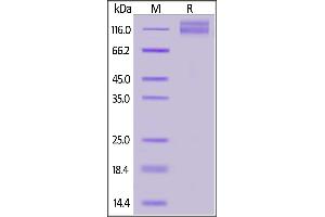 Human ITGAV&ITGB1 Heterodimer Protein, Tag Free&Tag Free on  under reducing (R) condition.