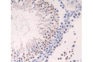 Used in DAB staining on fromalin fixed paraffin- embedded Kidney tissue (Aurora Kinase C anticorps  (AA 20-277))