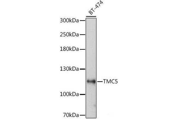 Tmc5 anticorps