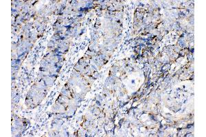 IHC analysis of Bax using anti-Bax antibody . (BAX anticorps  (N-Term))