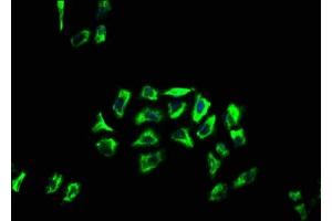 Immunofluorescence staining of Hela cells with ABIN7144431 at 1:66, counter-stained with DAPI. (APOLD1 anticorps  (AA 213-274))