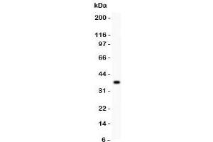 Western blot testing of CD86 antibody and recombinant human protein (0.