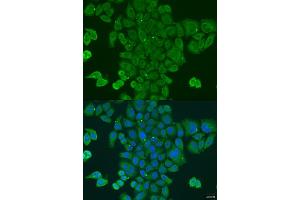 Immunofluorescence analysis of U2OS cells using DPM1 antibody (ABIN2736653) at dilution of 1:100.