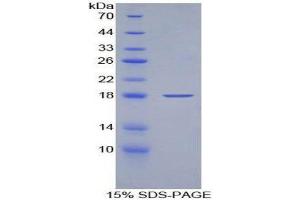 SDS-PAGE (SDS) image for Keratin 19 (KRT19) (AA 245-391) protein (His tag) (ABIN1170820)
