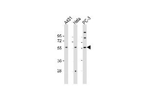 Western Blot at 1:2000 dilution Lane 1: A431 whole cell lysate Lane 2: Hela whole cell lysate Lane 3: PC-3 whole cell lysate Lysates/proteins at 20 ug per lane. (CCT8L2 anticorps  (AA 511-542))