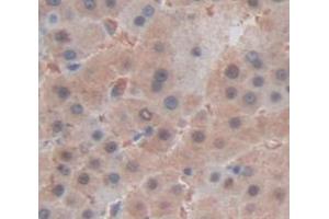 IHC-P analysis of Human Tissue, with DAB staining. (HSPB3 anticorps  (AA 1-150))