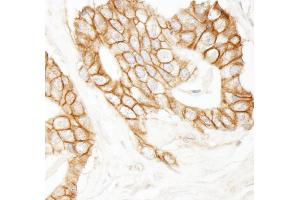Immunohistochemistry (IHC) image for anti-Catenin, beta (CATNB) (AA 760-781) antibody (ABIN7454800)