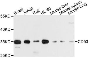 Western blot analysis of extracts of various cells, using CD53 antibody. (CD53 anticorps)