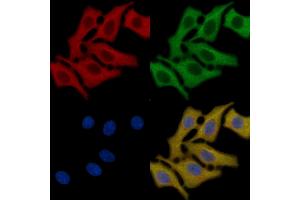AQP2 Mouse Monoclonal Antibody staining HepG2 cells by IF/ICC.