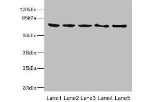 Western blot All lanes: PLK3 antibody at 1. (PLK3 anticorps  (AA 487-646))