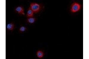 Immunofluorescent analysis of Syntaxin 1A (pS14) staining in NIH3T3 cells. (STX1A anticorps  (N-Term, pSer14))