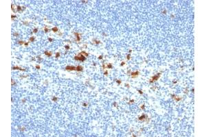 Formalin-fixed, paraffin-embedded human Tonsil stained with CD103 Mouse Monoclonal Antibody (ITGAE/2474).