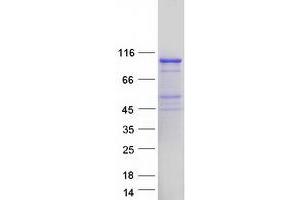 Validation with Western Blot
