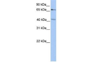 CHST13 antibody used at 1 ug/ml to detect target protein. (CHST13 anticorps)