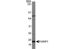 Western blot analysis of FUSIP1, isoform 3, in HepG2 whole cell lysates using FUSIP1 polyclonal antibody . (SRSF10 anticorps  (AA 100-200))