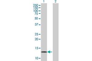 Western Blot analysis of LDOC1 expression in transfected 293T cell line by LDOC1 MaxPab polyclonal antibody.