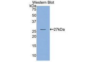 Western Blotting (WB) image for anti-Myosin Light Chain Kinase (MYLK) (AA 1661-1877) antibody (ABIN1859947) (MYLK anticorps  (AA 1661-1877))
