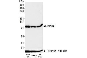 Western Blotting (WB) image for anti-Enhancer of Zeste Homolog 2 (EZH2) (C-Term) antibody (ABIN7795723) (Recombinant EZH2 anticorps  (C-Term))