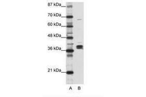 Image no. 1 for anti-Heterogeneous Nuclear Ribonucleoprotein D-Like (HNRPDL) (AA 119-168) antibody (ABIN203083) (HNRPDL anticorps  (AA 119-168))
