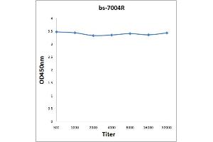 Antigen: 0. (PRAME anticorps  (AA 151-250))