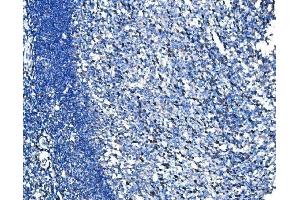 IHC analysis of HSPA6 using anti-HSPA6 antibody (ABIN7601944). (HSPA6 anticorps  (AA 516-643))