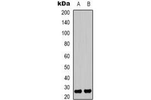 Western blot analysis of HMGB1 (AcK12) expression in NIH3T3 (A), HepG2 UV-treated (B) whole cell lysates. (HMGB1 anticorps  (acLys12, N-Term))