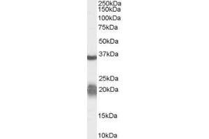 Western Blotting (WB) image for anti-Arginase, Liver (ARG1) (AA 316-330) antibody (ABIN295463) (Liver Arginase anticorps  (AA 316-330))