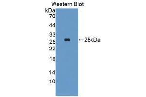 Western blot analysis of recombinant Human ALT. (ALT anticorps  (AA 255-496))