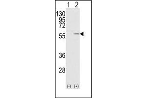 Image no. 1 for anti-Vimentin (VIM) antibody (ABIN357886) (Vimentin anticorps)