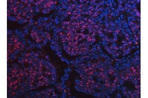 IF analysis of SCML1 using anti-SCML1 antibody (ABIN7602479). (SCML1 anticorps  (AA 8-322))