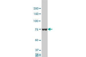 HNRPM monoclonal antibody (M03), clone 3F7 Western Blot analysis of HNRPM expression in HepG2 .