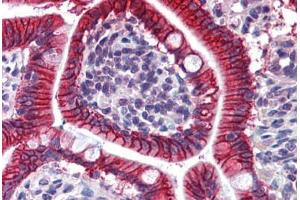 Human Small Intestine: Formalin-Fixed, Paraffin-Embedded (FFPE) (LI Cadherin anticorps  (AA 24-132))