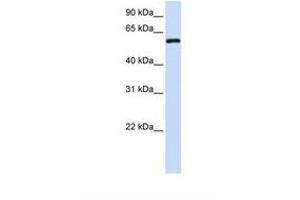 Image no. 1 for anti-Metaxin 1 (MTX1) (AA 326-375) antibody (ABIN6738154) (Metaxin 1 anticorps  (AA 326-375))