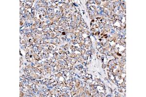 IHC analysis of Paxillin/PXN using anti-Paxillin/PXN antibody (ABIN7602636). (Paxillin anticorps  (AA 9-570))