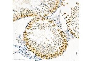 Immunohistochemistry of paraffin embedded mouse testis using SLBP (ABIN7075733) at dilution of 1: 700 (300x lens)