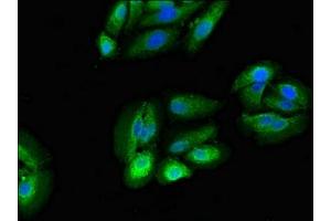 Immunofluorescent analysis of HepG2 cells using ABIN7142563 at dilution of 1:100 and Alexa Fluor 488-congugated AffiniPure Goat Anti-Rabbit IgG(H+L)