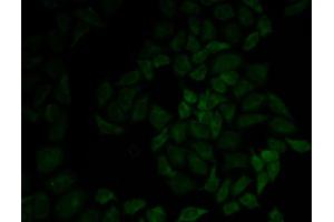 Immunofluorescence analysis of HeLa cells using MSN antibody. (Moesin anticorps  (AA 1-300))