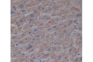 Used in DAB staining on fromalin fixed paraffin- embedded liver tissue