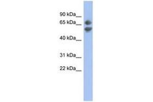 Image no. 1 for anti-Programmed Cell Death 7 (PDCD7) (C-Term) antibody (ABIN6744321) (PDCD7 anticorps  (C-Term))