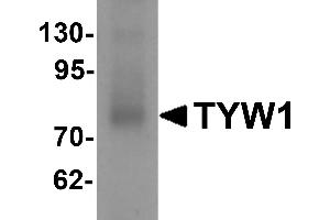 Western blot analysis of TYW1 in human lung tissue lysate with TYW1 antibody at 1 µg/mL. (TYW1 anticorps  (C-Term))