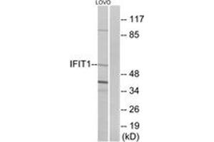 Western Blotting (WB) image for anti-Interferon-Induced Protein with Tetratricopeptide Repeats 1 (IFIT1) (AA 41-90) antibody (ABIN2889970) (IFIT1 anticorps  (AA 41-90))