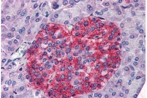 Human Pancreas (formalin-fixed, paraffin-embedded) stained with ANXA10 antibody ABIN351461 at 3. (Annexin a10 anticorps  (AA 2-16))