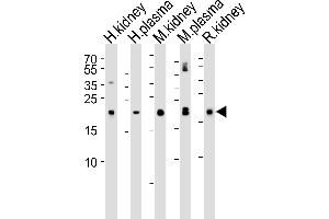 Western blot analysis of lysates from human kidney, plasma, mouse kidney, plasma and rat kidney tissue lysate(from left to right), using GPX3 Antibody (Center) (ABIN650617 and ABIN2844787).