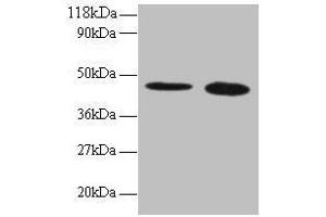 Western blot All lanes: TTC1 antibody at 2 μg/mL Lane 1: 293T whole cell lysate Lane 2: EC109 whole cell lysate Secondary Goat polyclonal to rabbit IgG at 1/15000 dilution Predicted band size: 34 kDa Observed band size: 45 kDa (TTC1 anticorps  (AA 3-292))