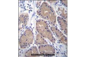 CA1 Antibody immunohistochemistry analysis in formalin fixed and paraffin embedded human stomach tissue followed by peroxidase conjugation of the secondary antibody and DAB staining. (CA1 anticorps  (N-Term))