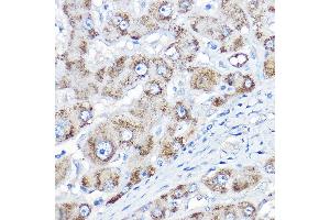Immunohistochemistry of paraffin-embedded human liver using AGXT Rabbit pAb  at dilution of 1:150 (40x lens). (AGXT anticorps  (AA 183-392))