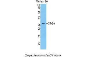 Detection of Recombinant aHSG, Mouse using Polyclonal Antibody to Alpha-2-Heremans Schmid Glycoprotein (AHSG)