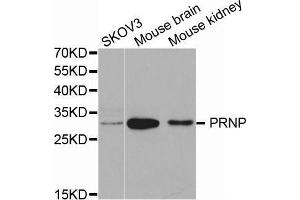 Western blot analysis of extracts of various cell lines, using PRNP antibody. (PRNP anticorps  (AA 23-230))