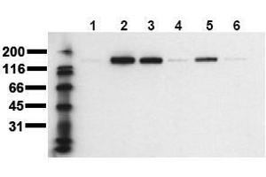 Western Blotting (WB) image for anti-Receptor tyrosine-protein kinase erbB-2 (ErbB2/Her2) (pThr686) antibody (ABIN126787) (ErbB2/Her2 anticorps  (pThr686))