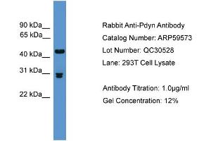 WB Suggested Anti-Pdyn  Antibody Titration: 0. (PDYN anticorps  (Middle Region))